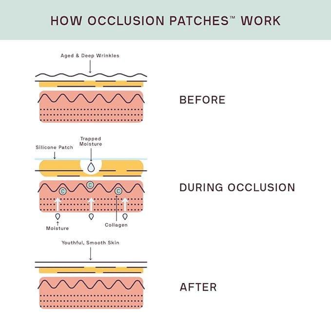 Enhanced Silicone Fusion Body Patch - Silicone Patches For Scars - Prevent and Treat Stretch Marks