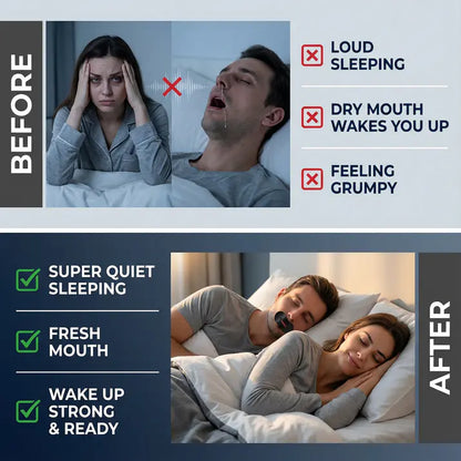 SleepPro Mouth Tape - Wake Up Energized with Deeper Sleep, Zero Snoring & Better Breathing