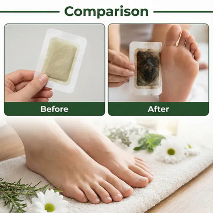 Herbal Detox Foot Patches - Natural Body Detox, Reduced Fatigue & Improved Circulation - Feel Lighter Every Morning