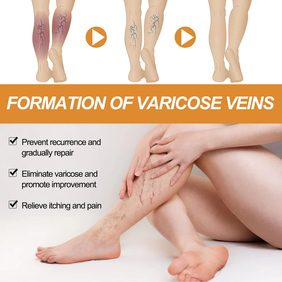 Turmeric Varicose Vein Relief Spray( BUY 1 GET 1 FREE💥 🎁  )