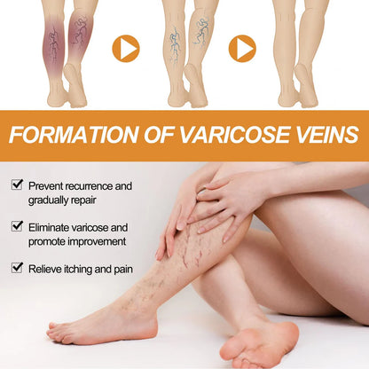 Turmeric Varicose Vein Relief Spray( BUY 1 GET 1 FREE💥 🎁  )